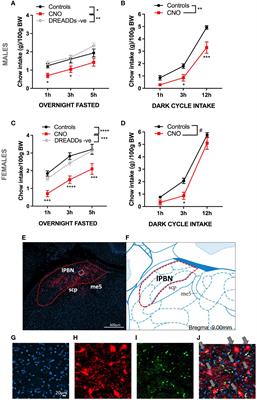 Lateral parabrachial nucleus astrocytes control food intake